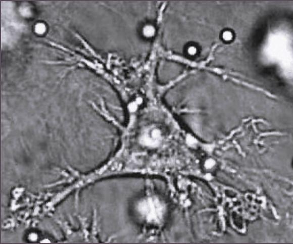 eine dendritische Zelle (Foto: wikimedia)